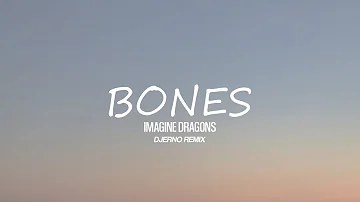 Imagine Dragons - Bones [DJErno Remix]
