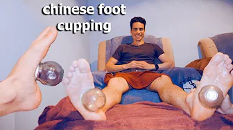 ASMR: Strong and Painful CHINESE Foot MASSAGE with FIRE CUPPING!