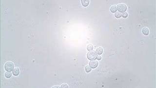 Budding and Shmooing - Yeast Reproduction