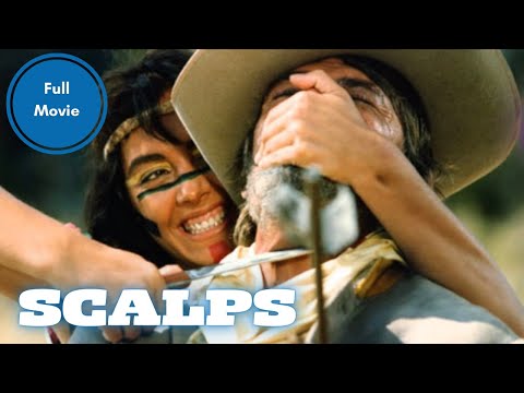 SCALPS