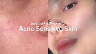 Skincare untuk Kulit Berjerawat dan Sensitif! Drugstore Product dari dulu sampai sekarang💕