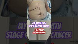 My battle with stage 4 kidney cancer cancer hope cancersurvivor