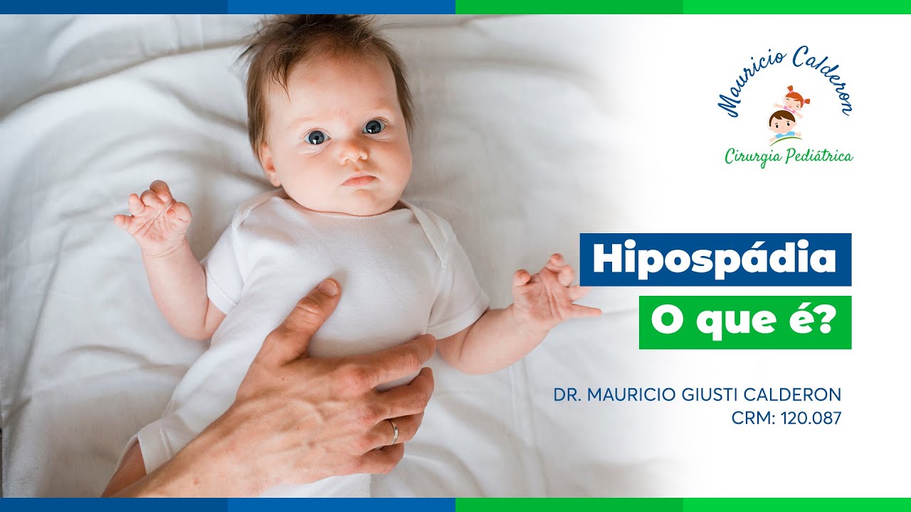 Hipospádia | O que é?