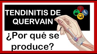 De Quervain's tenosynovitis: What is the treatment?