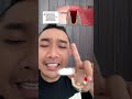 GARA GARA ROKOK PROSES PENYEMBUHAN LUKA SETELAH CABUT JADI INFEKSI😭 #prosespenyembuhanlukacabutgigi