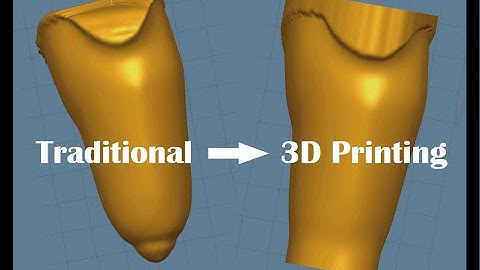 Traditional Socket Scan to 3D Printing Ready