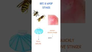 BEE & WASP STINGS NURSING CARE