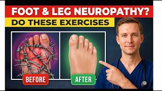The ONLY 6 Exercises YOU Need to Relieve Neuropathy in Feet & Legs