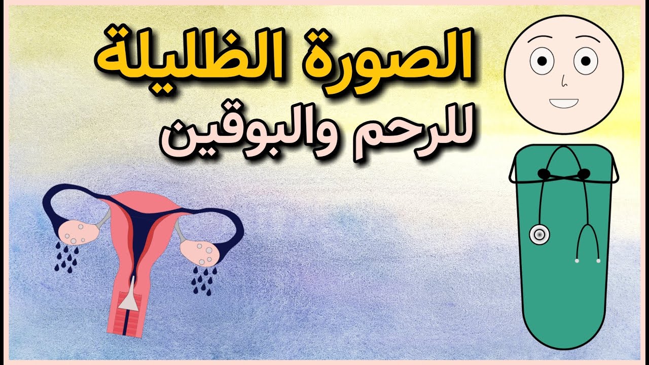 الصورة الظليلة للرحم والبوقين - سؤال وجواب