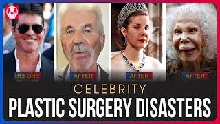 10 Celebrity Plastic Surgery Disasters | You’d Never Recognize Today