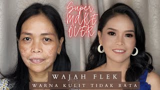 SUPER MAKE OVER | FLEK & WARNA KULIT TIDAK RATA
