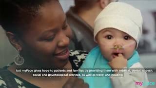 Famous Watch what one of the stars of "WONDER" has to say Profile