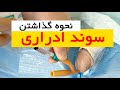 نحوه گذاشتن سوند ادراری دکتر سید امین میرصادقی 