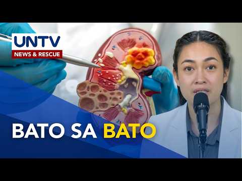 Paano nakukuha ang kidney stones o bato at paano ito maiiwasan? | Good Morning Kuya