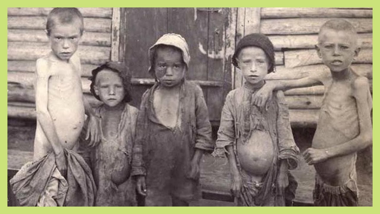 Worst Famines In History | 10 Terrible Famines in History – PWJC