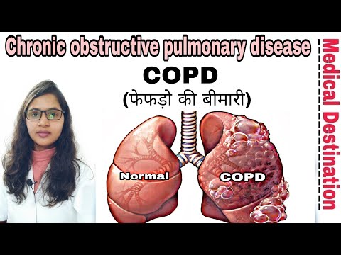 Video: Penyedut Untuk Merawat COPD: Jenis, Arahan, Kebaikan Dan Kekurangan