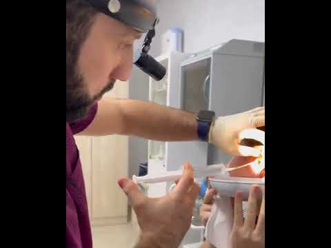 Видео: Как удалить воду из ушей: 13 шагов (с иллюстрациями)