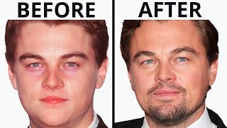 Has Leonardo DiCaprio Had Plastic Surgery? | Plastic Surgery Analysis