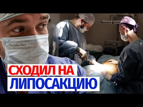 ЛИПОСАКЦИЯ: Самая большая по смертности операция в пластической хирургии