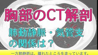 胸部CTの解剖の基礎(Chest CT)