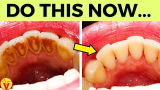 Natural Solution for Plaque, Cavities, and Gingivitis | #1 Top Remedy | VisitJoy by VisitJoy 3,891 views 2 months ago 9 minutes, 31 seconds