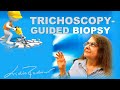How to make a trichoscopy-guided scalp biopsy ?
