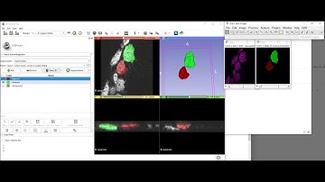 3D Slicer for annotating microscopy data