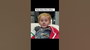 People Before And After Going Missing #shorts #trending