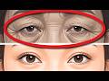 《Japanese》👁️ No eye surgery
