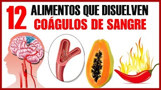 Los 12 Mejores Alimentos Para Derretir COÁGULOS De Sangre De Forma Natural