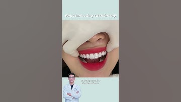 Nụ cười chuẩn tỉ lệ vàng, thần thái nâng tầm 💎 #nhakhoataman #rangsu #rangsuthammy #rangsucaocap