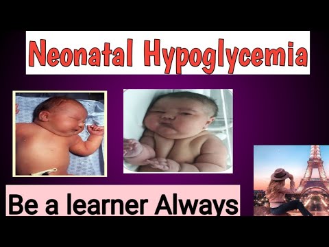 Video: Hypokalcemi: Definition Och Patientutbildning