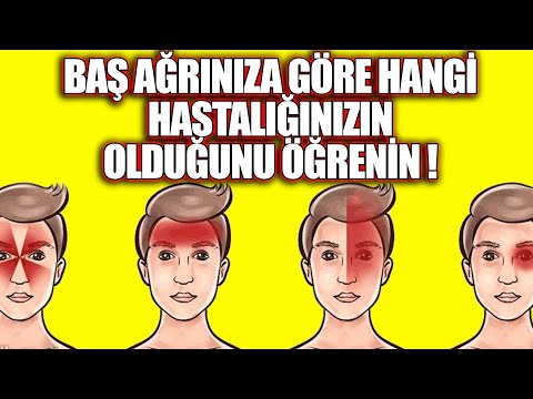 9 Tip Baş ağrısı var. Bunun 8 Tanesi Ciddi Peki Bu Hangi hastalık Belirtisidir ?