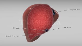 Liver transplant: Living donor right lobe (recipient procedure)