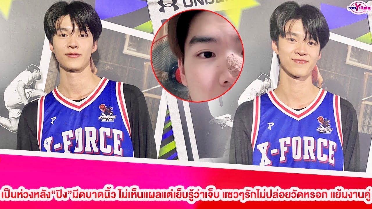 “มีน นิชคุณ”ห่วงหลัง”ปิง”มีดบาดนิ้ว ไม่เห็นแผลแต่เย็บรูู้ว่าเจ็บ แซวๆรักไม่ปล่อยวัดหรอก แย้มงานคู่