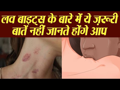 लव के बारे में महत्वपूर्ण बातें | लव बाइट कैसे दें | लव बाइट अज्ञात तथ्य | फीचर