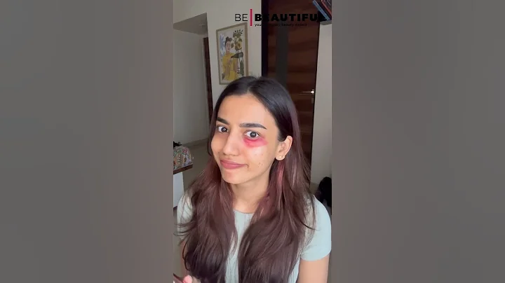3 Simple Steps To Conceal Your Dark Circles | Makeup Hacks | Be Beautiful #Shorts