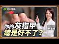 灰指甲不一定是灰的！小心「這習慣」不改全家都遭殃｜蔡逸姍 皮膚科醫師【早安健康X健康大頭條】