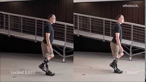 C-Brace vs LKAFO:  Level Walking