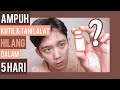 (TANPA OPERASI) menghilangkan kutil dan tahi lalat dalam 5 hari | Swiss Paris Lotion