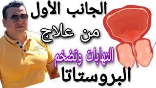 الجانب الأول من علاج التهابات وتضخم البروستاتا  الاسباب والعلاج بدون أثار جانبيه