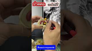 ปวดคอ เอาไงดี?? #หมอเก่งกระดูกและข้อ #ปวดคอ #ปวดคอร้าวลงแขน #ปวดคอบ่าไหล่ #หมอนรองกระดูกเสื่อม