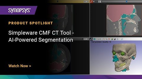 Simpleware CMF CT Tool - AI-Powered Segmentation