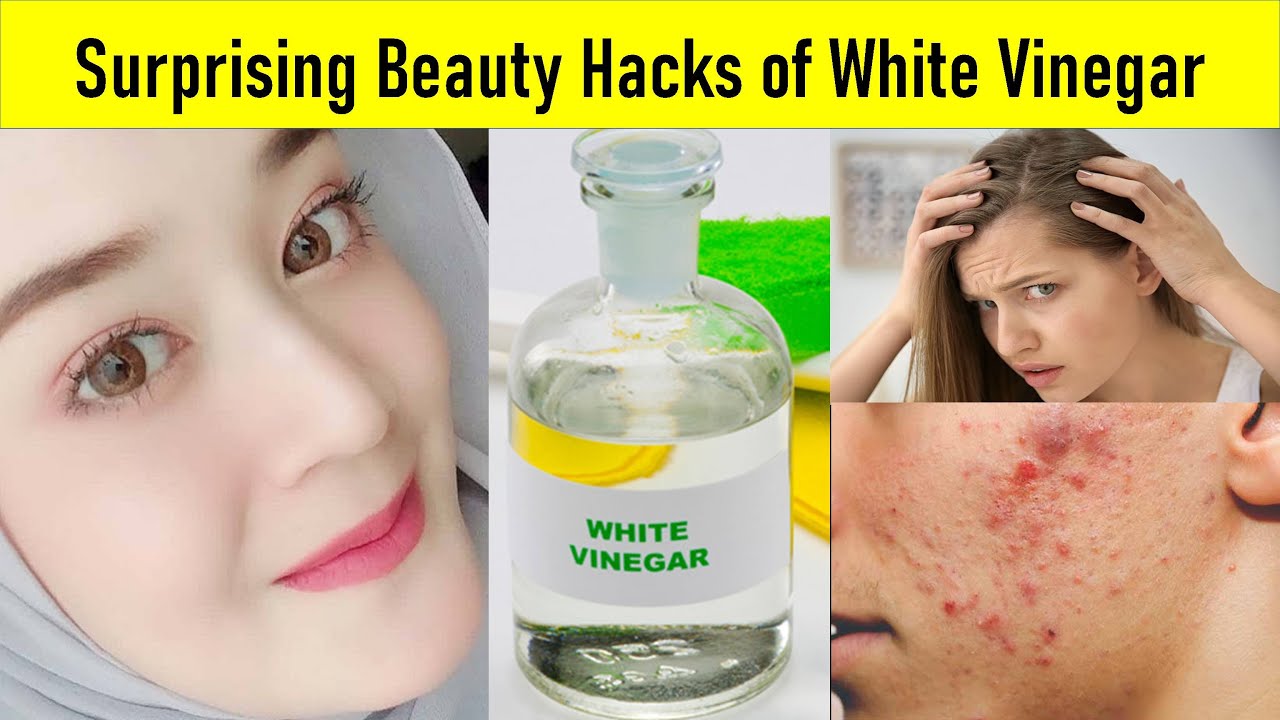 5 Surprising Beauty Hacks Of White Vinegar Vinegar Beauty Hacks Youtube