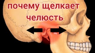 видео: Что делать если ЧЕЛЮСТЬ щелкает? ЩЕЛЧКИ в челюсти при открывании рта. Почему ЩЕЛКАЕТ челюсть? картинка: Что делать если ЧЕЛЮСТЬ щелкает? ЩЕЛЧКИ в челюсти при открывании рта. Почему ЩЕЛКАЕТ челюсть?