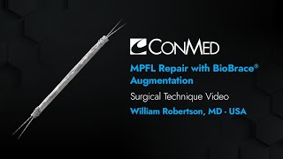 Dr. William Robertson - Mpfl Repair With Biobrace® Augmentation - Conmed Surgical Technique
