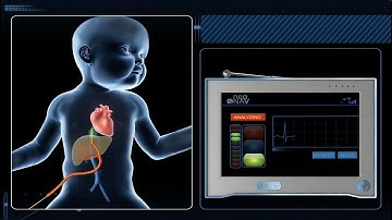 Introducing the Actuator - Australia