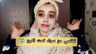 وصفة سحرية لتبيض الوجه إزالة سواد تحت العين?تفتيح4درجات أسبوع واحد?