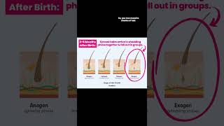 Going Bald After Baby?