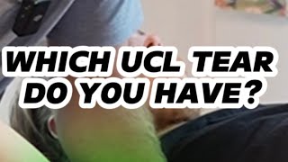 Your UCL Is Torn - Which Part? Dr. Kam Explains What Calls For Surgery